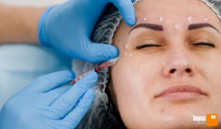 Toxina Botulínica (Botox): Tudo o que Você Precisa Saber Sobre o Tratamento