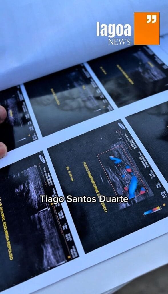 Paciente denúncia falhas médicas e infecções após diversas cirurgias em Lagoa Santa 2 Paciente denuncia falhas médicas e infecções em Lagoa Santa 02